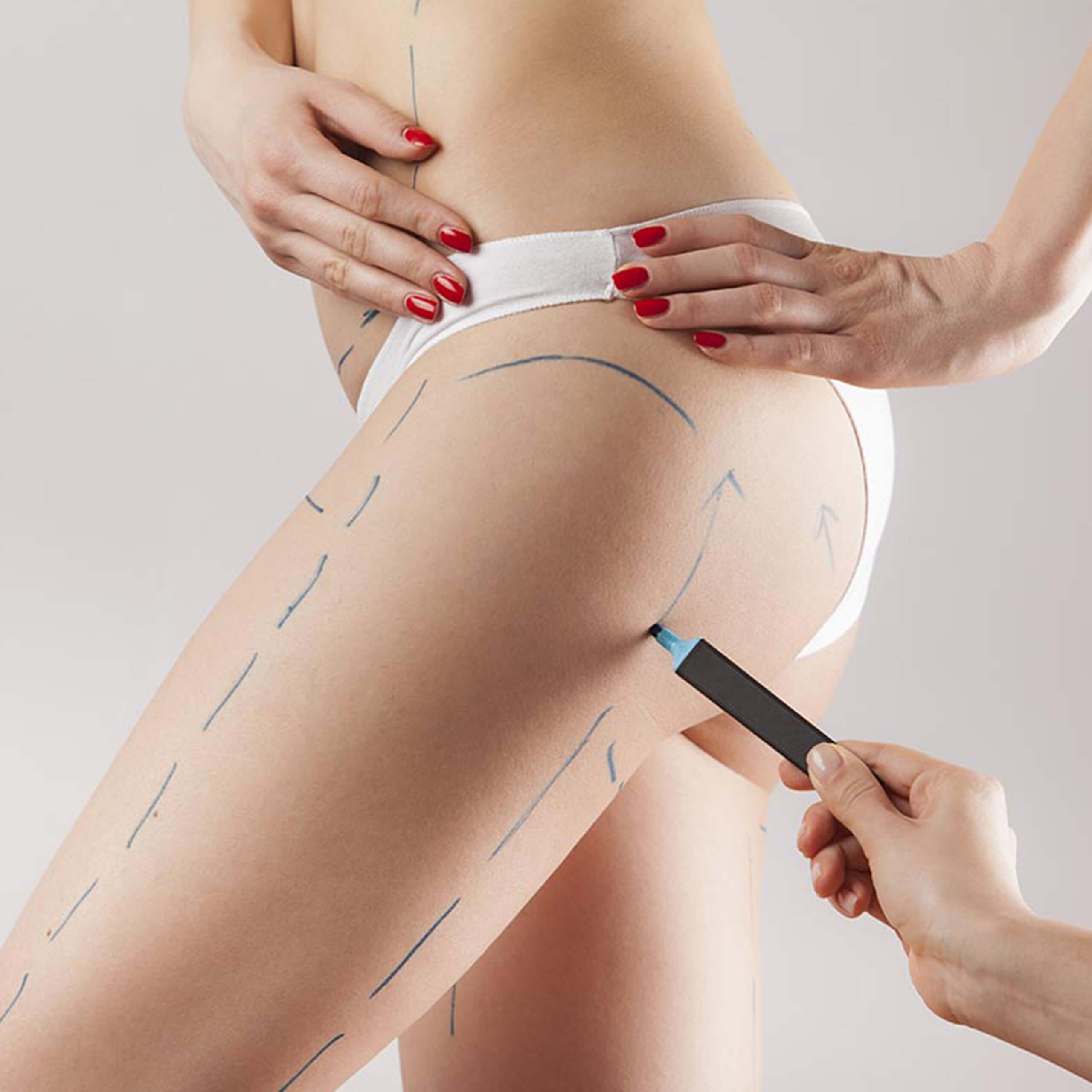 Lipo 360º Lipo 360º