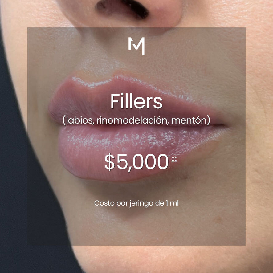 Fillers