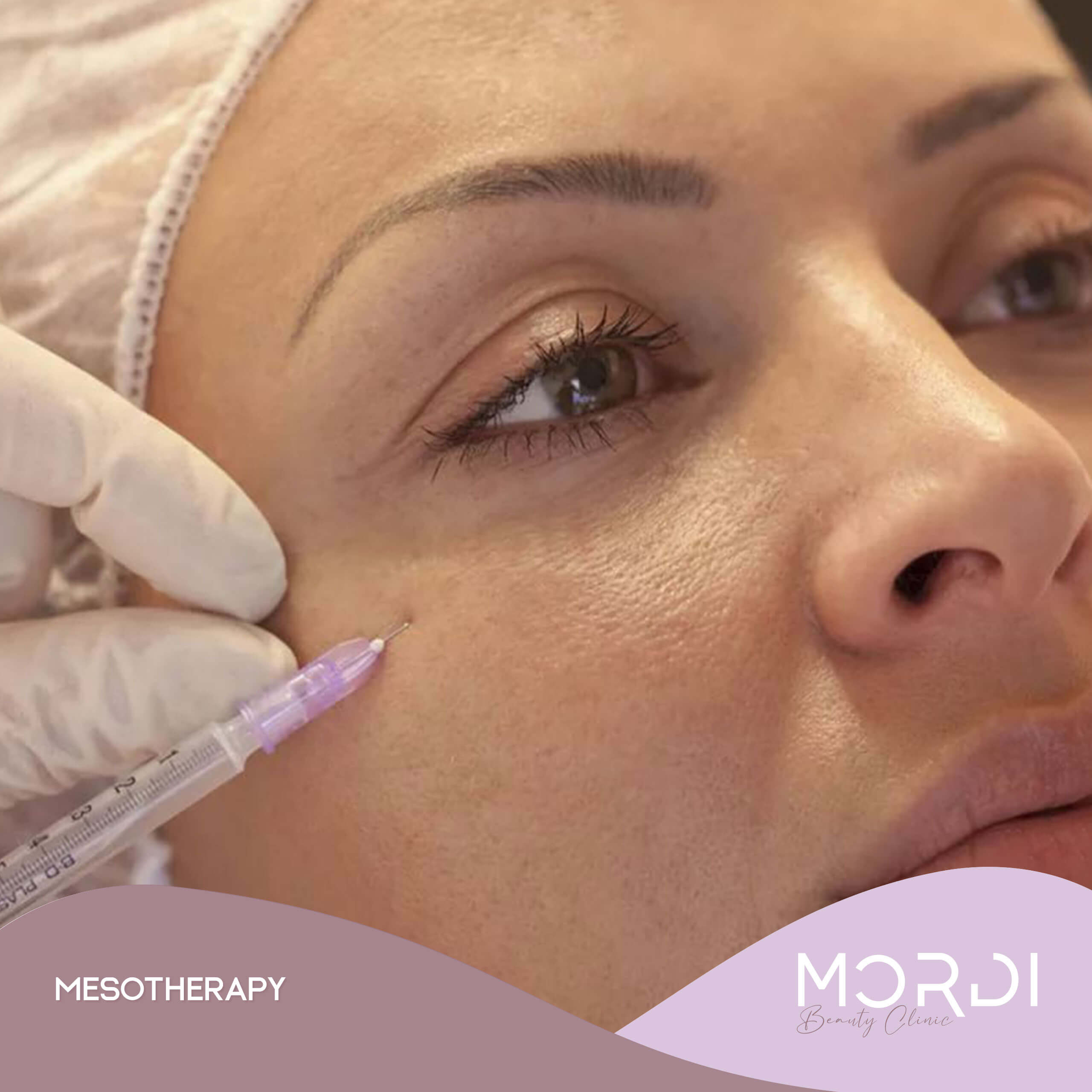 Mesotherapy Mesotherapy